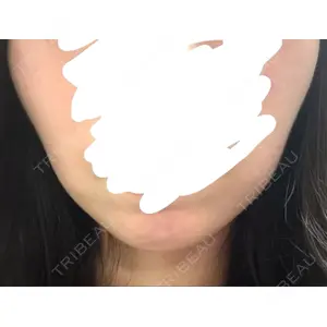 HAAB CLINIC HAAB CLINIC 福岡院口コミ
