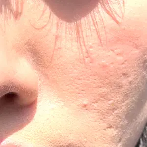 muni skin clinic muni skin clinic口コミ