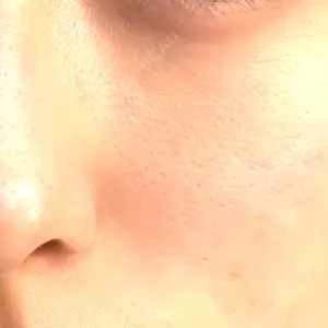 muni skin clinic muni skin clinic口コミ
