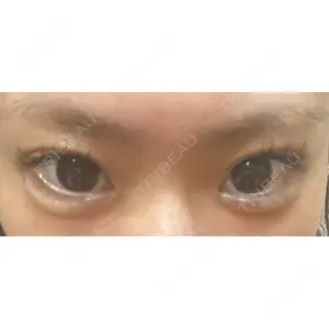 プロクリニック PRO CLINIC プロクリニック 銀座院口コミ