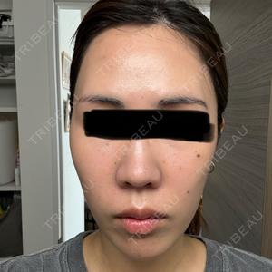 LIFIX BEAUTY CLINIC口コミ
