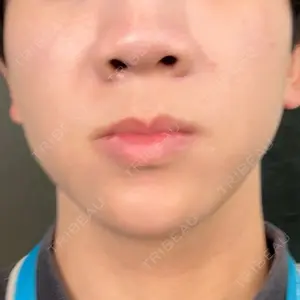 白金ビークリニック 本院口コミ