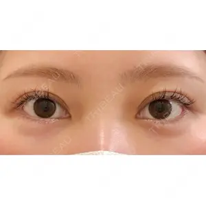 BIANCA CLINIC BIANCA銀座口コミ