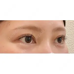 BIANCA CLINIC BIANCA銀座口コミ