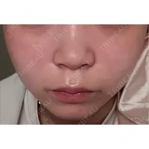 BITO BEAUTY CLINIC BITO BEAUTY CLINIC口コミ