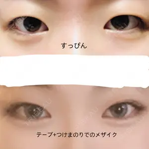 FROM B整形外科 (旧バウム整形外科)口コミ