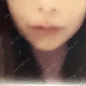 白金ビークリニック 本院口コミ