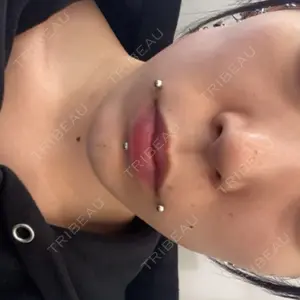 ルラ美容クリニック ルラ美容クリニック 新宿院口コミ