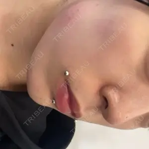 ルラ美容クリニック ルラ美容クリニック 新宿院口コミ