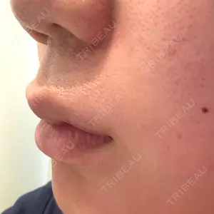 プロクリニック PRO CLINIC プロクリニック 銀座院口コミ