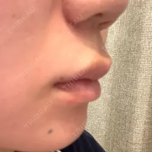 プロクリニック PRO CLINIC プロクリニック 銀座院口コミ