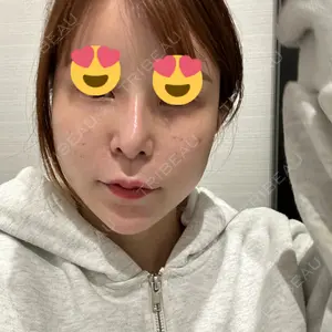 HAAB CLINIC HAAB BEAUTY CLINIC 名古屋院口コミ