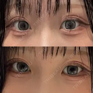 東京シンデレラ美容外科 東京シンデレラ美容外科 池袋院口コミ