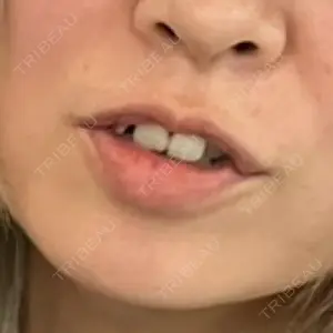 白金ビークリニック 本院口コミ