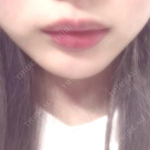 TCB東京中央美容外科 TCB東京中央美容外科 広島院口コミ