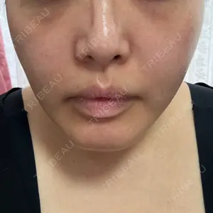 AZ BEAUTY CLINIC口コミ