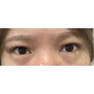 BIANCA CLINIC BIANCA銀座口コミ