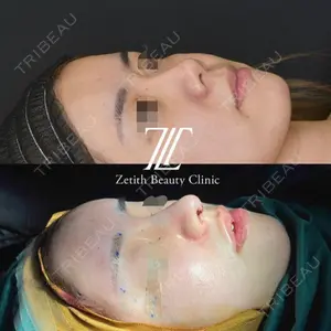 Zetith Beauty Clinic 銀座院口コミ