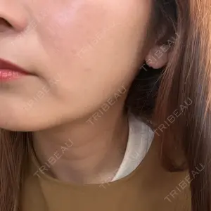 口コミ