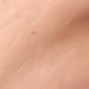 やさしい美容皮膚科・皮フ科 やさしい美容皮膚科・皮フ科　東京浅草院口コミ