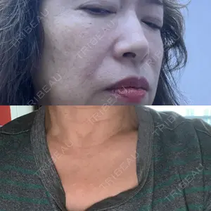 HAAB CLINIC HAAB BEAUTY CLINIC 名古屋院口コミ