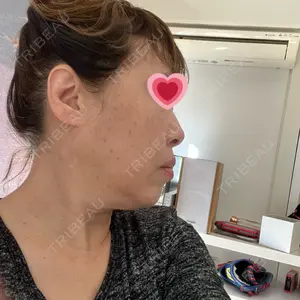 HAAB CLINIC HAAB BEAUTY CLINIC 名古屋院口コミ