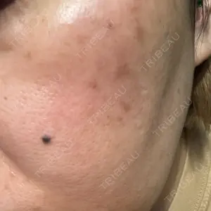 聖心美容クリニック グループ S-Laboクリニック 渋谷院口コミ