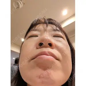 ルラ美容クリニック ルラ美容クリニック 新宿院口コミ