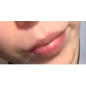 ゼノクリニック口コミ