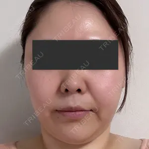 オアシス美容外科口コミ