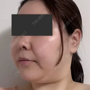 オアシス美容外科口コミ