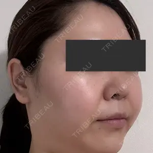 オアシス美容外科口コミ