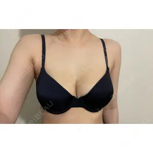 Lipo Clinic omotesando口コミ