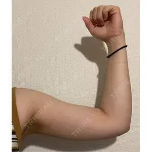 Lipo Clinic omotesando口コミ