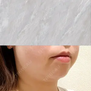 ルラ美容クリニック ルラ美容クリニック 大宮院 / ルラスキンクリニック 大宮院口コミ