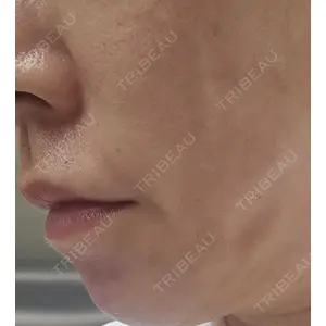 ルラ美容クリニック ルラ美容クリニック銀座院口コミ
