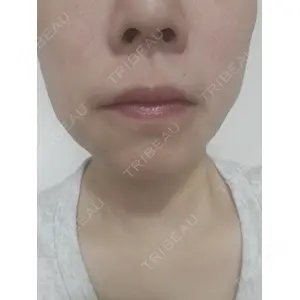 ルラ美容クリニック ルラ美容クリニック銀座院口コミ