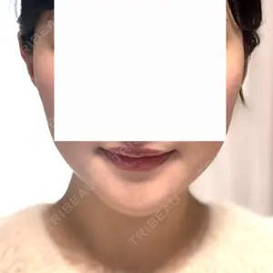 口コミ