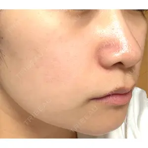 ルラ美容クリニック ルラ美容クリニック 札幌本院口コミ