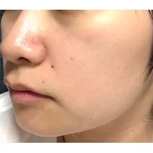 ルラ美容クリニック ルラ美容クリニック 札幌本院口コミ