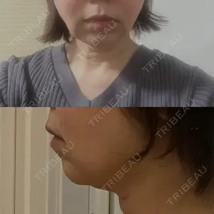 ルラ美容クリニック 大阪本院の