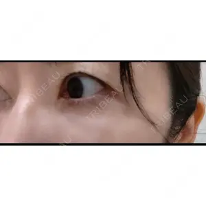 TCB東京中央美容外科 TCB東京中央美容外科 岡山院口コミ