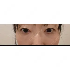 TCB東京中央美容外科 TCB東京中央美容外科 岡山院口コミ