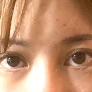 プロクリニック PRO CLINIC プロクリニック 銀座院口コミ