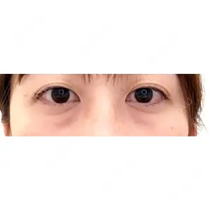 HAAB CLINIC HAAB BEAUTY CLINIC 名古屋院口コミ