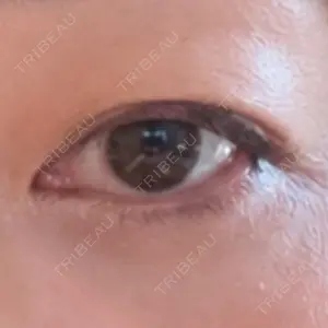 HAAB CLINIC HAAB×DREAM BEAUTY CLINIC 大阪梅田院口コミ