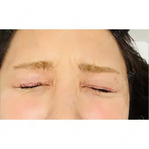 プロクリニック PRO CLINIC プロクリニック 銀座院口コミ