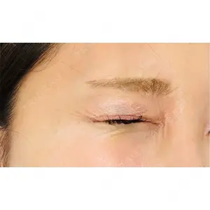プロクリニック PRO CLINIC プロクリニック 銀座院口コミ