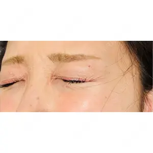 プロクリニック PRO CLINIC プロクリニック 銀座院口コミ