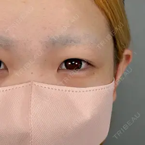 アリエル美容クリニック アリエル美容クリニック 大宮院口コミ
